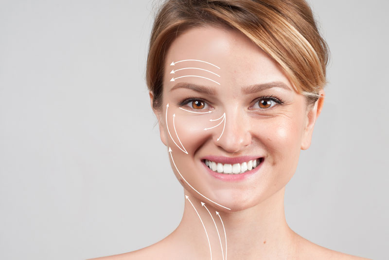 botox patient smiling