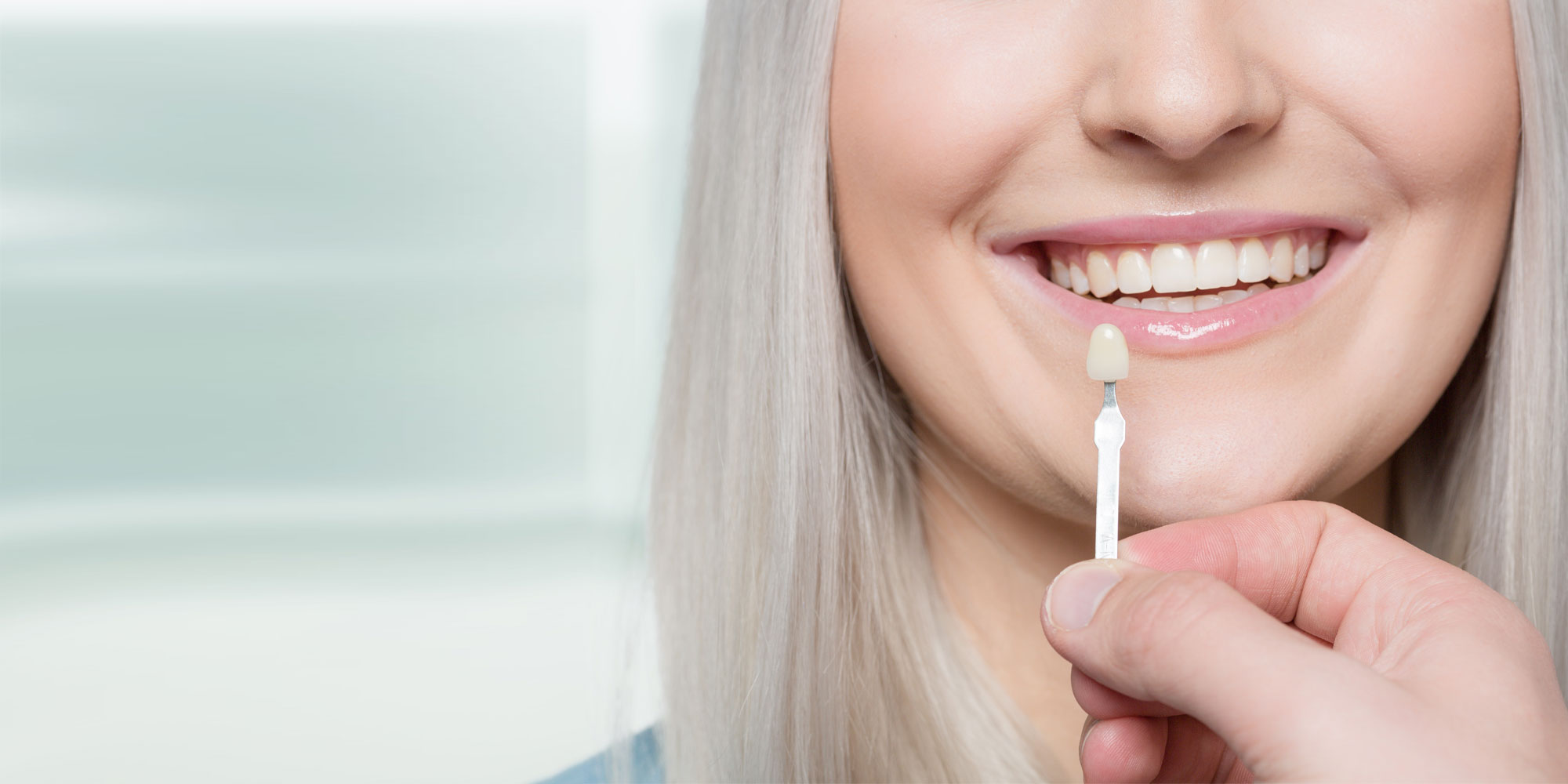 dental veneers patient smiling
