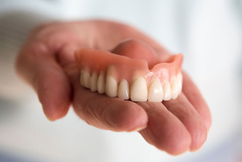 dentures-model